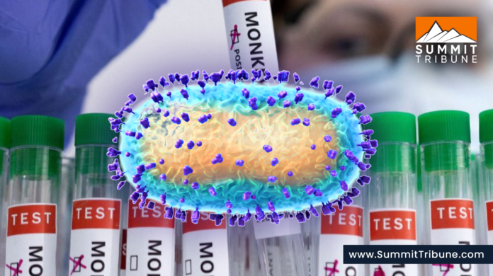 Pakistan reports one case of Mpox virus so far, confirmed Health Authorities Pakistan reports one case of Mpox virus so far, confirmed Health Authorities